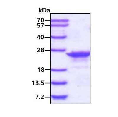 SDS-PAGE: Recombinant Human transgelin 2 His Protein [NBP1-51013]